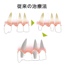 従来の治療法