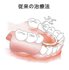 従来の治療法