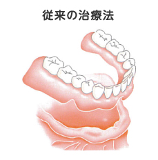 従来の治療法