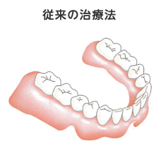 従来の治療法